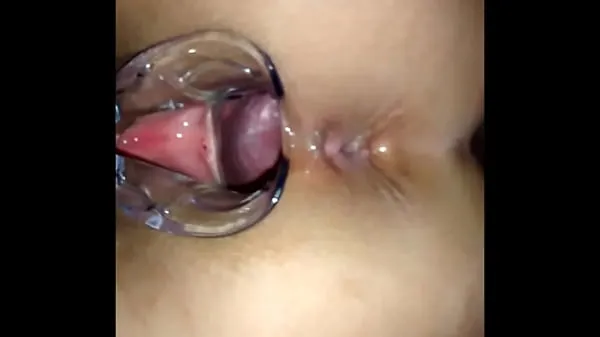 XXX Inside the pussy with vaginal speculum mega Tube