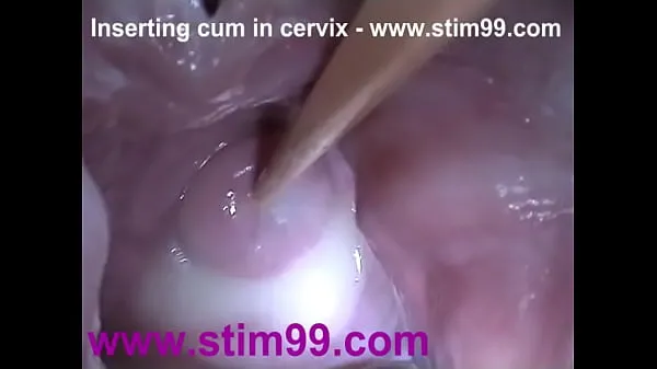 XXX Insertion Semen Cum in Cervix Wide Stretching Pussy Speculum mega trubica